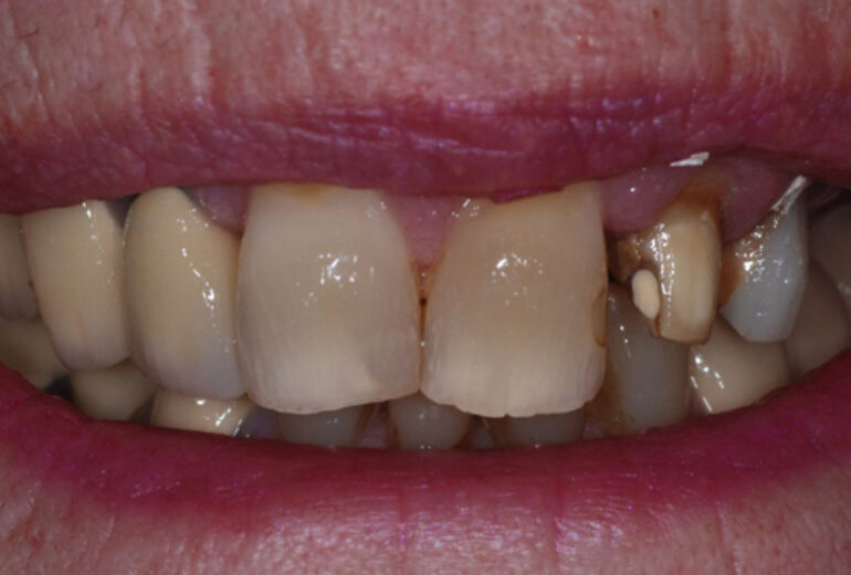 Before - Dorset Dental