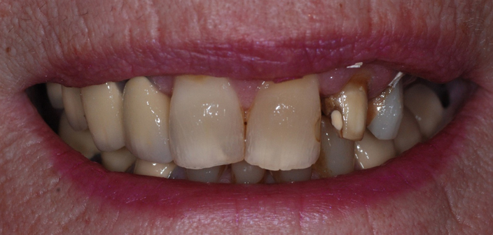 Before - Dorset Dental