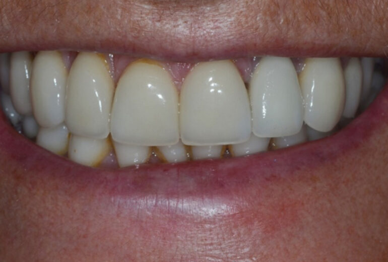 After - Dorset Dental