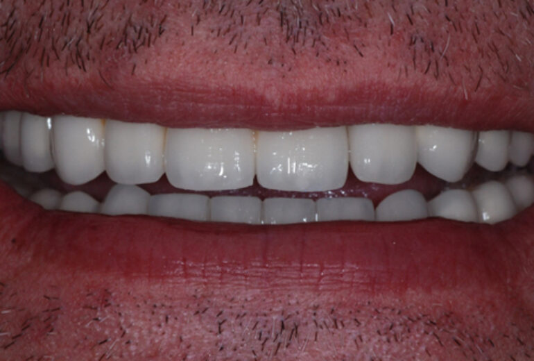 After - Dorset Dental