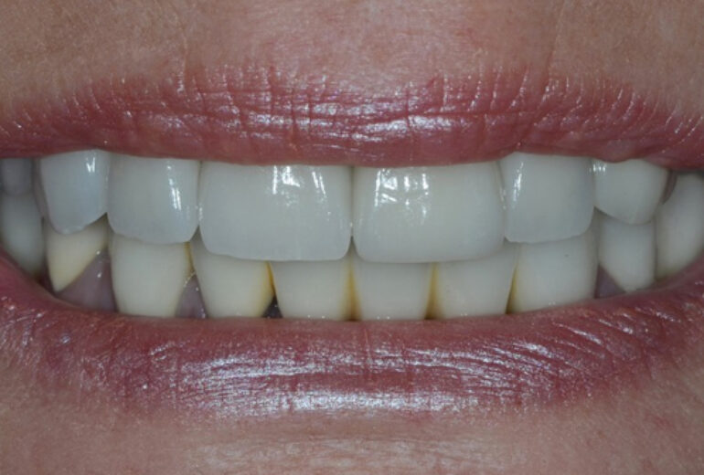 After - Dorset Dental