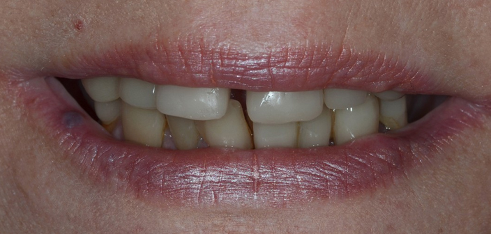 Before - Dorset Dental