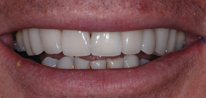 After - Dorset Dental