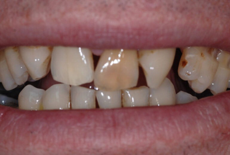 Before - Dorset Dental