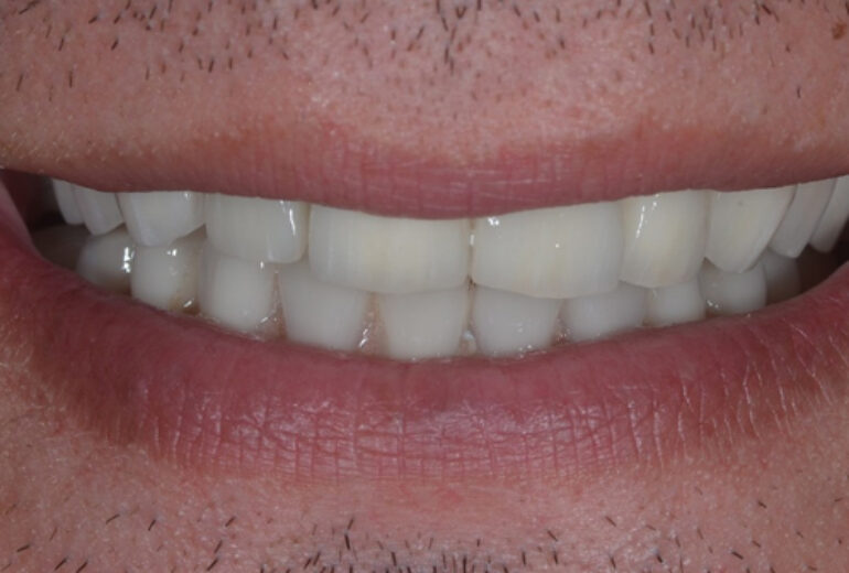 After - Dorset Dental