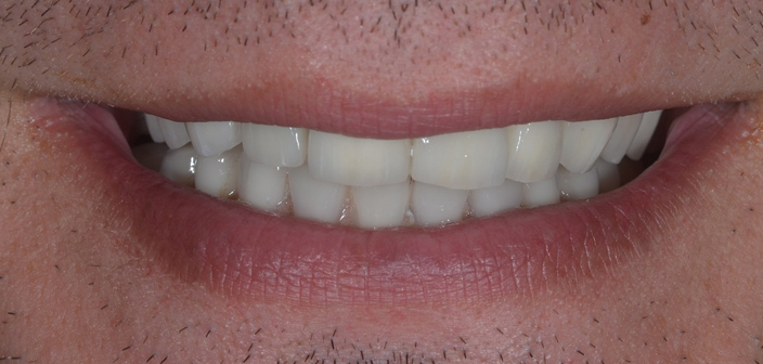 After - Dorset Dental