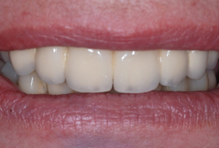 After - Dorset Dental