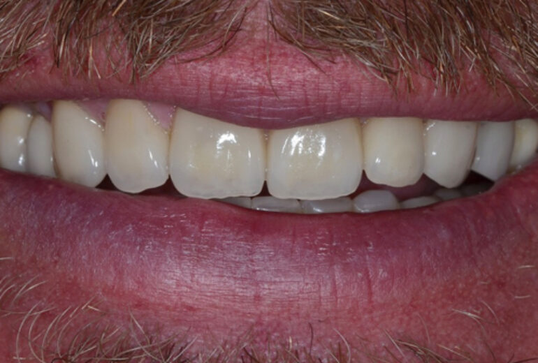 After - Dorset Dental