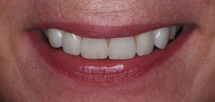 After - Dorset Dental