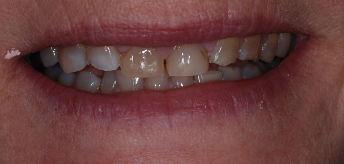 Before - Dorset Dental