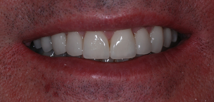After - Dorset Dental