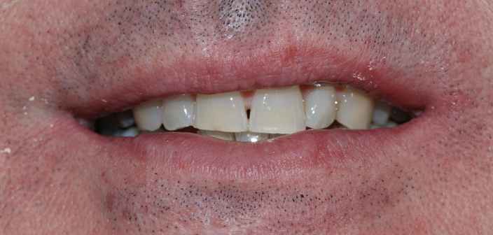 Before - Dorset Dental