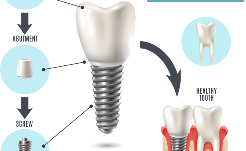 blog - Dorset Dental
