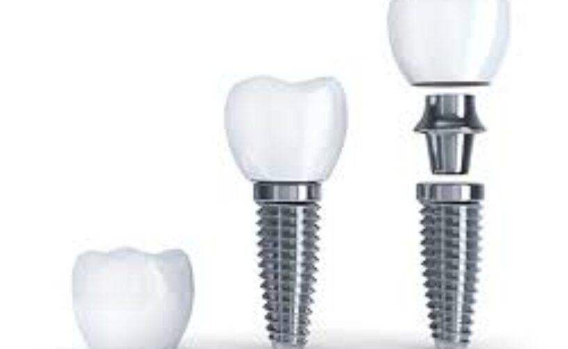 blog - Dorset Dental