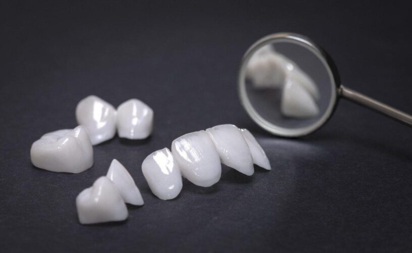 blog - Dorset Dental