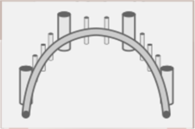 Dental Weld Case Image